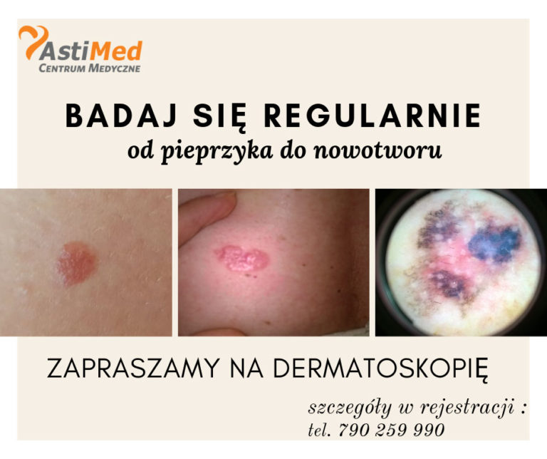 Dermatoskopia Astimed Centrum Medyczne Warszawa Bielany 4454